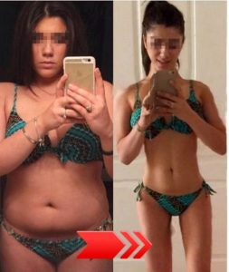 話題沸騰！家庭用美容機器で自宅から美容維持