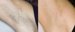 X ダウンシェイプ効果なし？履くだけじゃだめ！？口コミ・評判を暴露