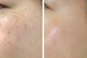 エクスグラマーの効果【憧れのバストサイズをGET】