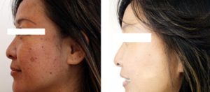 実は痩せない？スリムーチョの低評価の口コミと評判でわかった事実