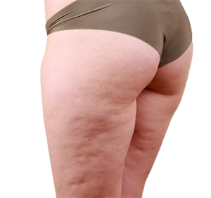 ビューティーリフトアップブラの効果とは？！口コミからわかる谷間メイクの真相に迫った！