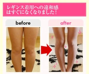 スラリんウォーマーには下半身痩せ効果なかった？口コミ評判と衝撃の事実