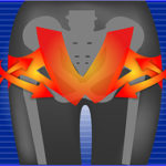 ビフィラプラスの口コミ評判・効果を徹底検証！