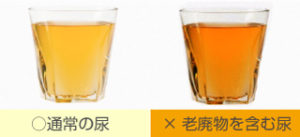 ビレッグで本当に痩せるの？楽天やAmazonでも購入できる？気になる効果や口コミ・評判を大調査！