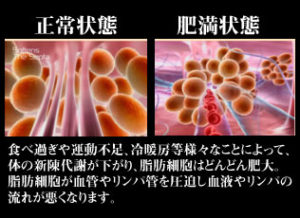 スラリックスでむくみは本当に解消できるのか！？飲むだけで痩せるなんて嘘じゃない？効果の真相・口コミ・評判を調べました！