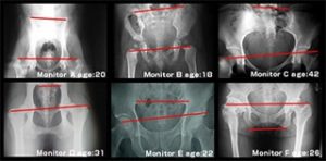 コストパフォーマンスが良く肌にもやさしいオールインワンゲル