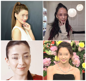 クリニックで女子力UPを目指せる！気になる悩みを解消しよう