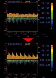 【 ブラジャー　カップ 】自分のカップ数の確認方法