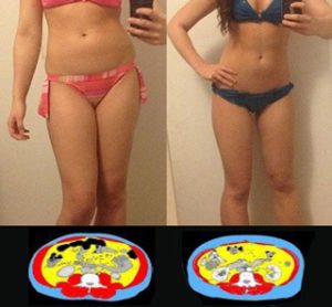 《緊急告知・速報！！美・マジックホワイリッチの最新口コミ！実際の効果やみんなの評価は？！今だけの🉐情報も！！》