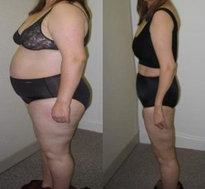 プルトは痩せない？効果は嘘だった！？Pult衝撃の事実はコチラ！安全性や副作用の情報もまとめました☆