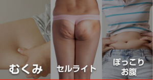 スリミータイムはダイエット効果なし！？購入前に悪い口コミを見ておこう！成分は安全？Amazonと公式サイトどっちがお得？