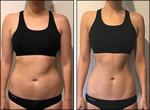 効果が怪しい…アルバニアホワイトニングクリームの口コミ・評判の疑いを調査！