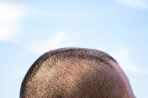 リスクのない治療