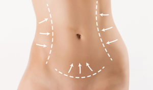 脂肪を除去しよう