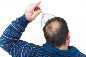 育毛のための効果