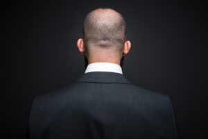 抜ける前からのヘアケア