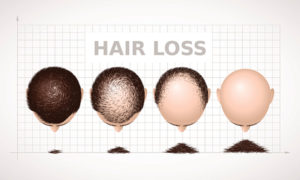 効果が高い専門病院