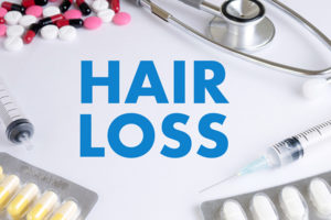 自毛植毛について。