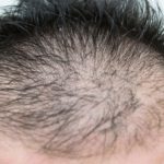 チャップアップは健康な髪の毛を取り戻したい・維持したい方に必要不可欠！