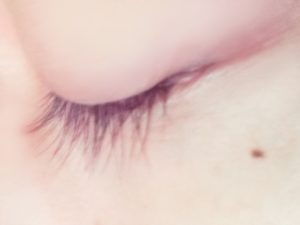 アイキララを使用して3ヶ月目…目元のクマがパッと目立たなくなってきた